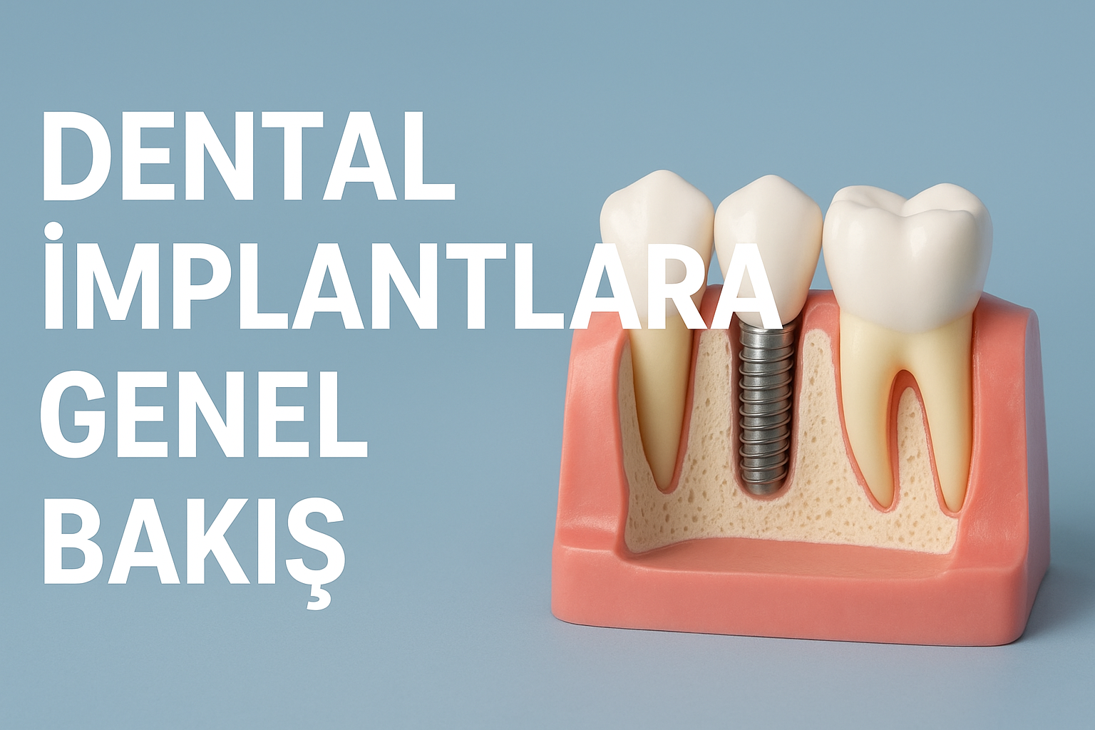 Dental İmplantlara Genel Bakış