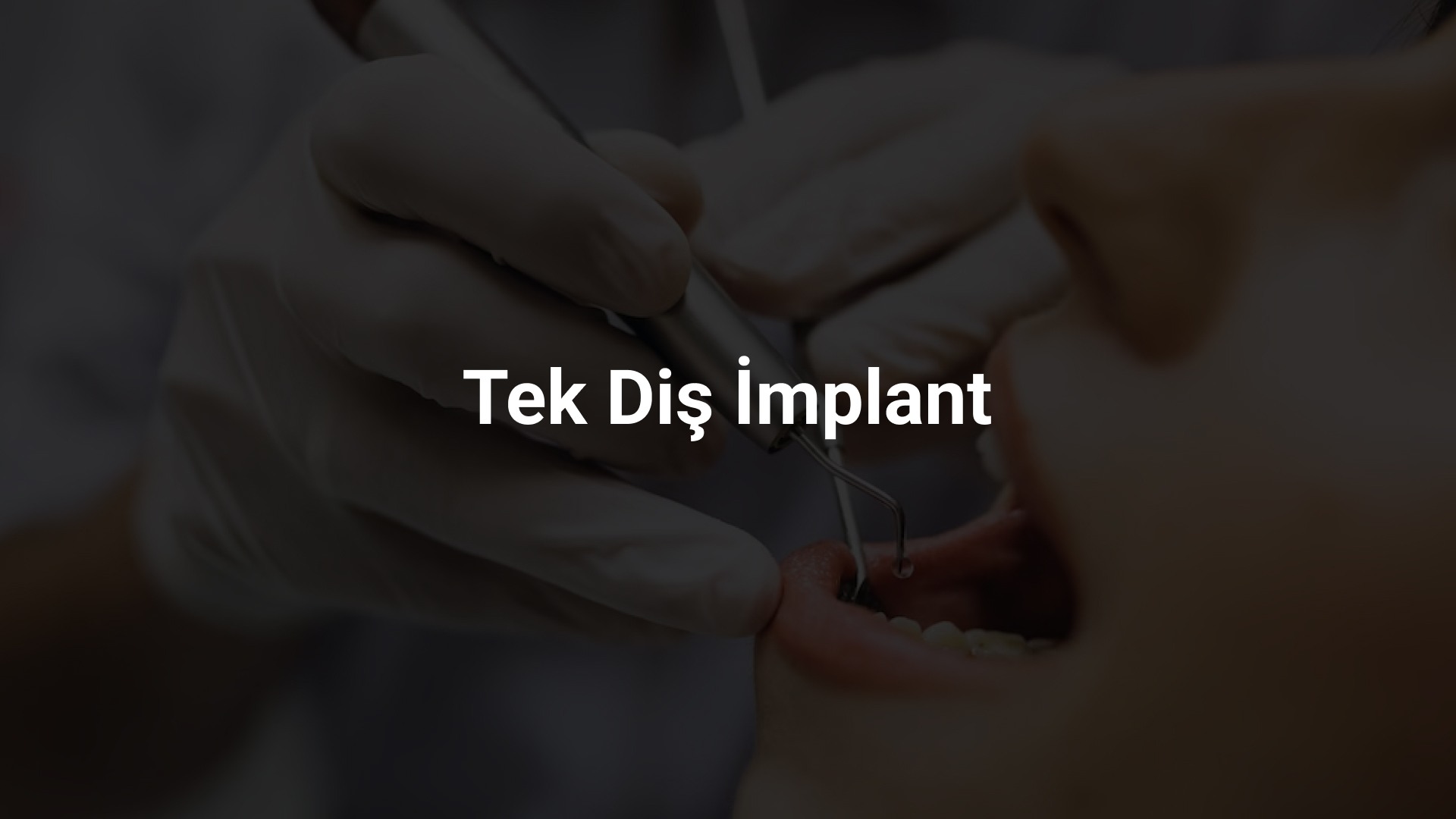 Tek Diş İmplant