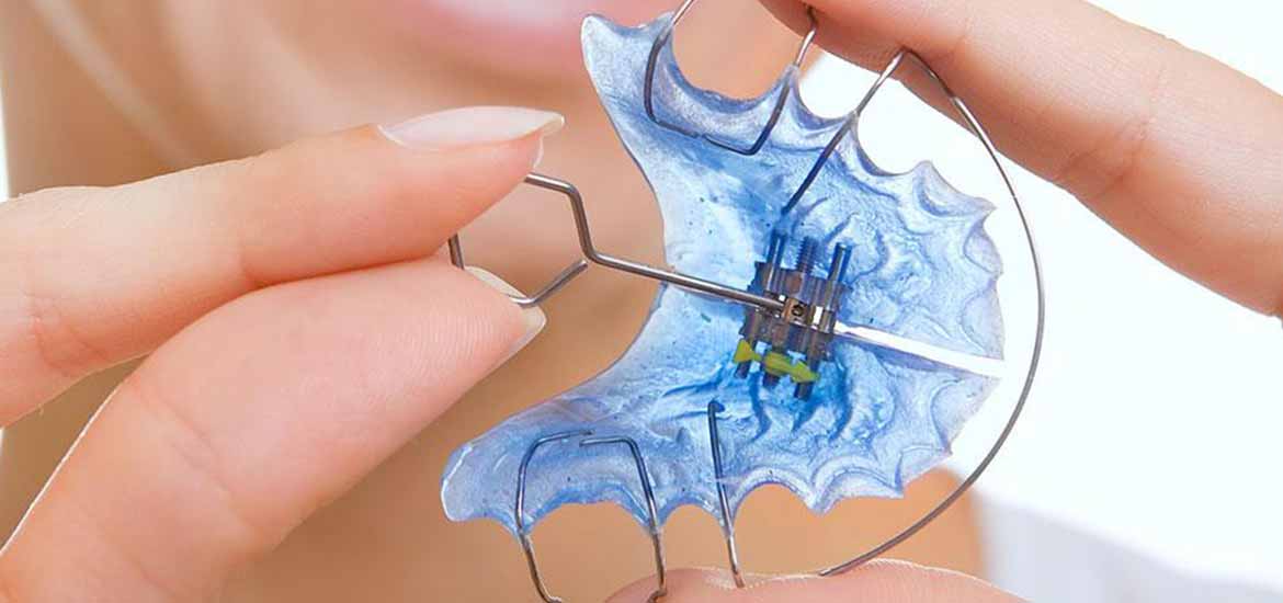 Hareketli Ortodontik Tedavi